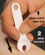 Human Removal